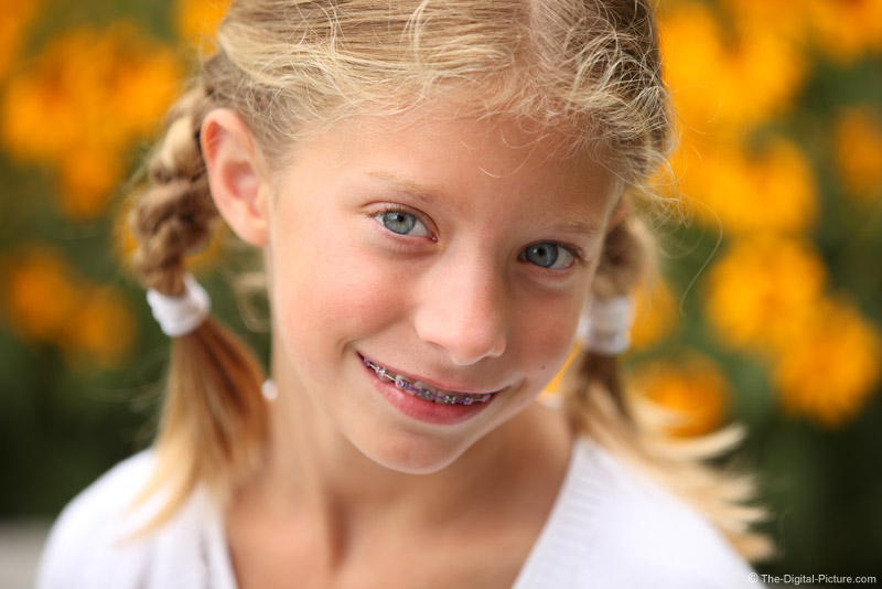 Braces And Braids Picture